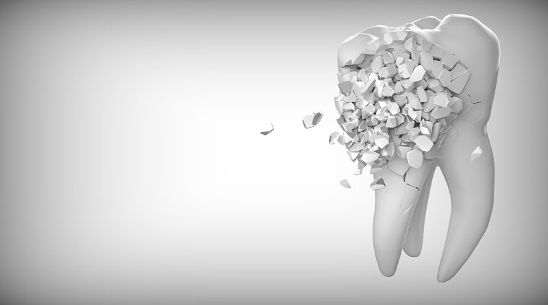 implant zęba z NFZ